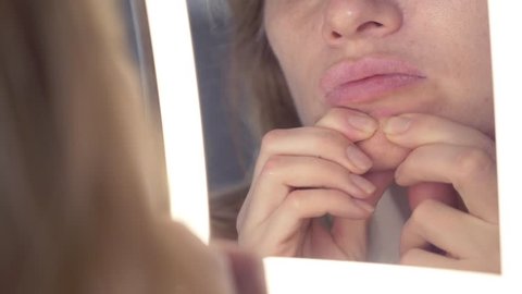 The woman squeezes acne, squeezes out pimples in front of the mirror. close-up, 
