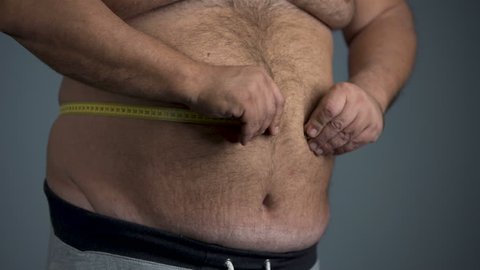 Sad overweight man unable to measure his waist, fat tummy with stretch marks