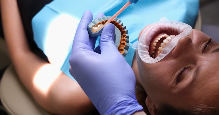 A woman with an open mouth with a dentist, a close-up. Preparation of a cast for an insert jaw | Shutterstock HD Video #3391079039