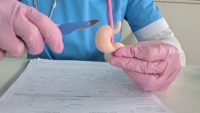 Surgeon held scalpel over an anatomical model of human stomach. Photosurgical treatment of stomach diseases and procedures Royalty-Free Stock Footage #3398169681