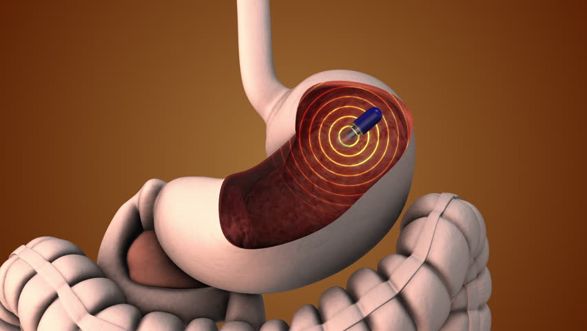Endoscopy of capsules and wireless transmission