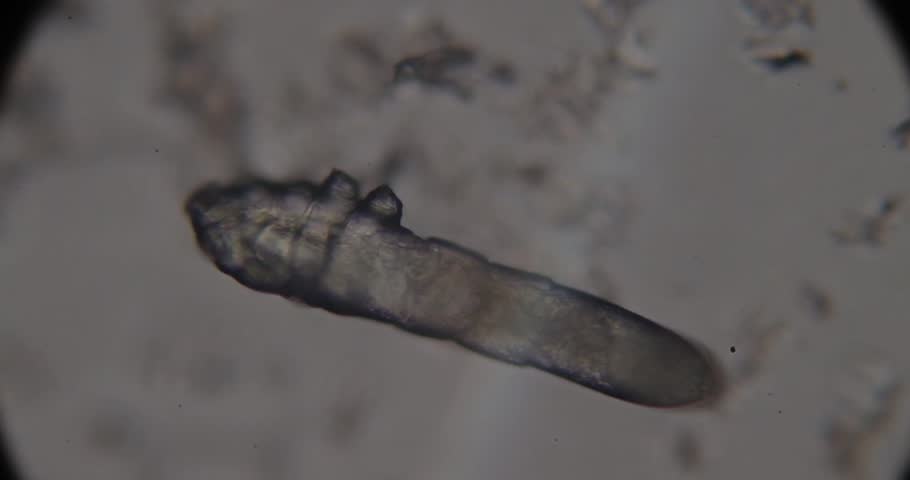 high resolution footage of face mite demodex under the microscope Royalty-Free Stock Footage #3411725845