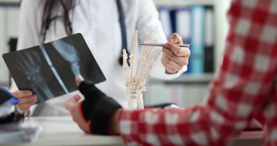 Orthopedist shows x-ray anatomy of hand and patient in clinic. Hand injury concept