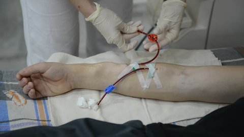 nurse prepares patient's arm for dialysis