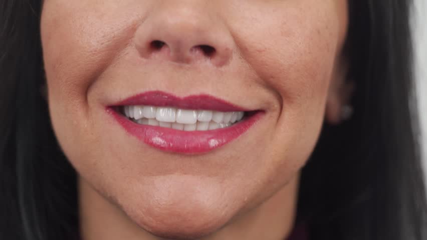 Close-up of woman's smile after installing zirconia veneers, dental ceramic crowns. Female patient smiling after cosmetic dental treatment of teeth by the porcelain veneers. Perfect hollywood smile. Royalty-Free Stock Footage #3418718563