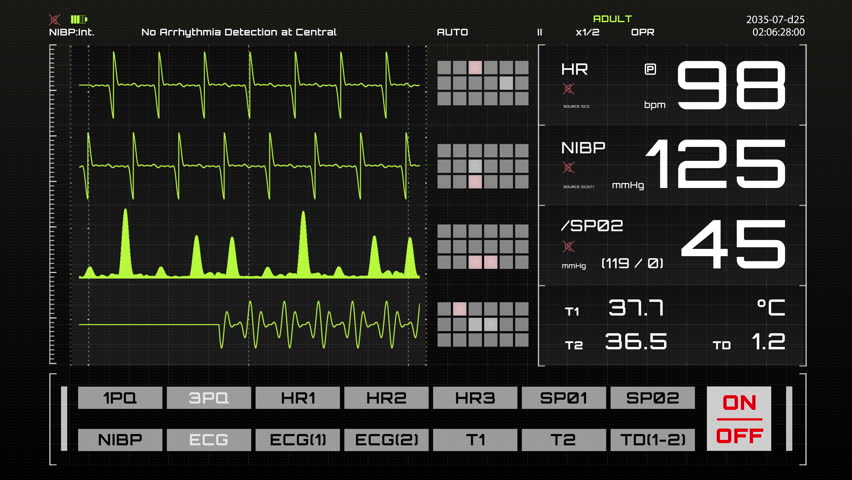 Vital Signs Monitor with Heart Rate and Other Medical Parameters on an Animated Mock-up. Patient's Vitals and ECG Graph for Intensive Care Unit Template for Computer Displays and Laptop Screens Royalty-Free Stock Footage #3420389805