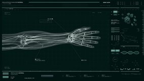 Using Medical Interface To Conduct Diagnostic Analysis Of Third Blood Type. Medical Interface For Diagnostic Blood Examination. Medical Scan Of Bloodstream In Vein. Diagnostic X-Ray Scanner Interface - Powered by Shutterstock - Get 15% off with code: PIKWIZARD15