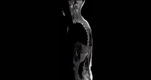 MRI scan of the full spine of a woman going side to side