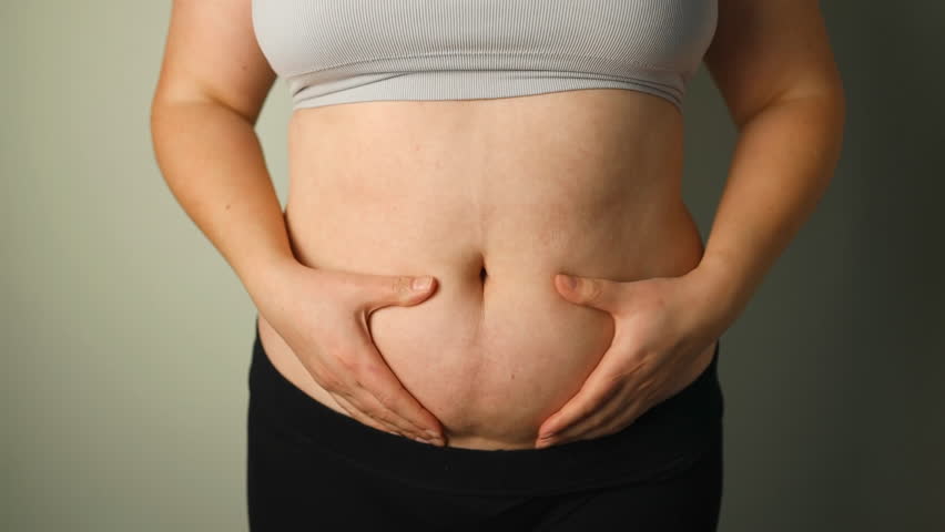 Closeup of fat folds on big belly of overweight woman. Concept of excessive weight, obese female, dieting and overweight problems. High quality FullHD footage