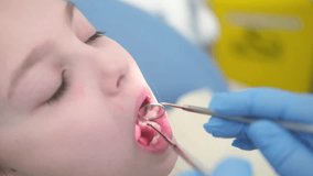 4k video. A pretty little girl is sitting in a dentist's chair, the doctor examines her teeth with a mirror and tweezers. in the dental office.