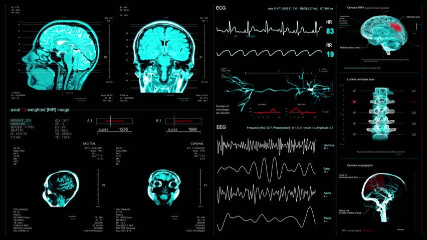 Diverse surgeons in AR headsets work in operating room. African American specialist uses AI virtual holographic display. 3D graphics of health monitors and human brain. Modern medical facilities.