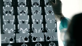 Doctor Checking Patient Diagnose. Neurologist Looking MRI Scan. Laboratory Clinic Brain Research. Radiology MRI Scan.Brain Screening Procedure.Therapist Diagnose Patient MRI Scan.Doctor Medical Report - Powered by Shutterstock - Get 15% off with code: PIKWIZARD15