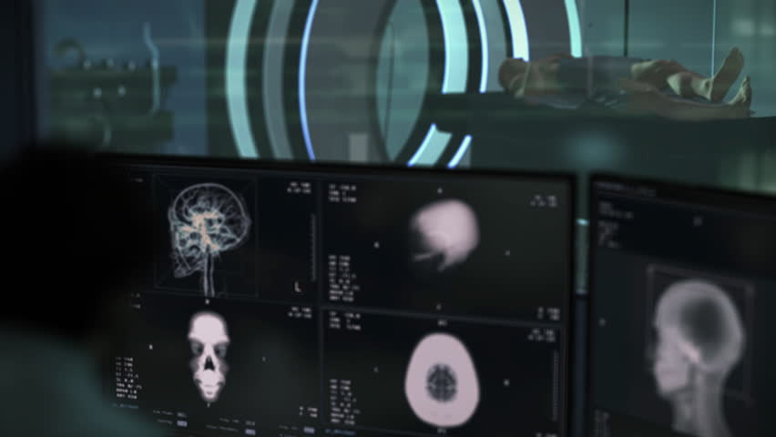 Doctor using modern medical analysis technology to examine the brain. Medical doctor analysing the skull of the sick person. Medical doctor analyses the x-ray scans of the patients head. - Powered by Shutterstock - Get 15% off with code: PIKWIZARD15