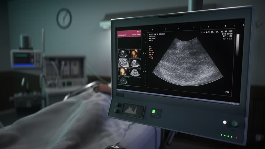 Hospital diagnostic scanner inspecting the unborn baby in the woman stomach. Hospital diagnostic scanner analysing the reproductive organs of a child. Hospital diagnostic scanner identifies the gender Royalty-Free Stock Footage #3438111507