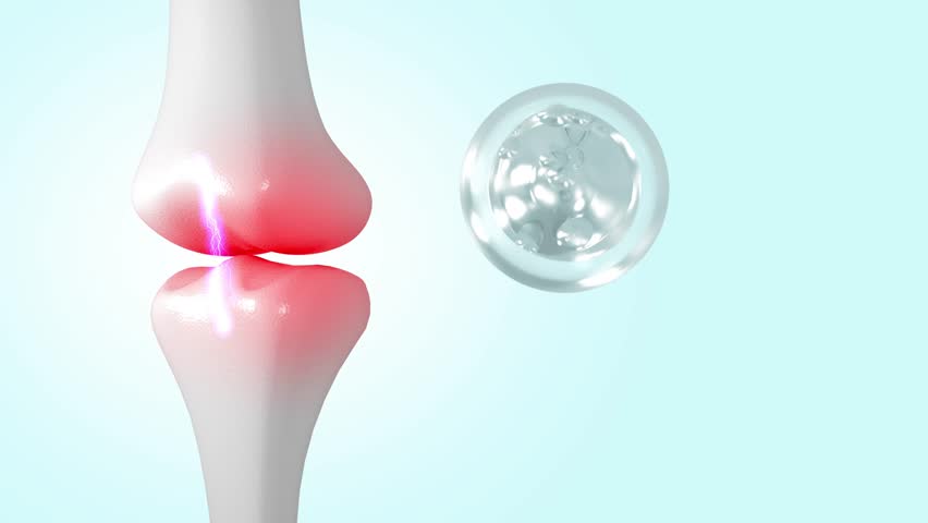 Knee pain due to collagen deterioration, 3D rendering Royalty-Free Stock Footage #3438448299