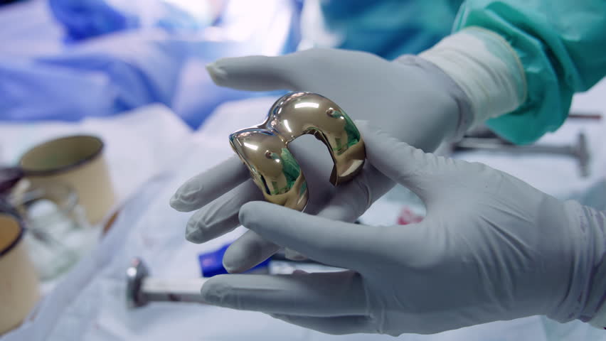 Hands of doctor in latex gloves holding a knee prosthesis. Materials for knee joint replacement. Close up. Royalty-Free Stock Footage #3439569883