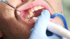 Close-up slow-motion video showcasing a dental rinse procedure, focusing on the precise application of water or disinfectant into a patient's mouth - Powered by Shutterstock - Get 15% off with code: PIKWIZARD15