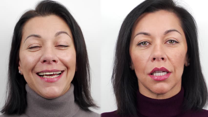 Woman before and after zirconia veneers, dental ceramic crowns. Female patient talk to camera before and after porcelain veneers. Smile makeover with dental veneers, before and after in dental clinic. Royalty-Free Stock Footage #3445354033
