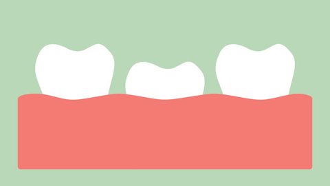 Loose Tooth Tooth Fall Out Gum Stock Vector (Royalty Free) 1669502482 ...