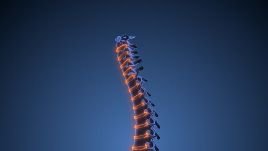 Human intervertebral disk pain medical concept
