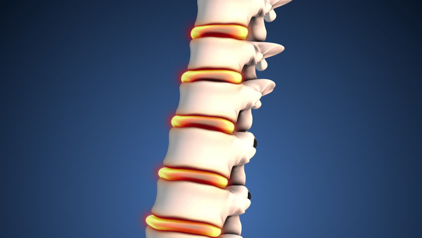 Human Spinal disc pain medical concept