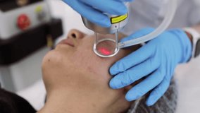 Fractional laser CO2 procedure. Cosmetic treatment in beauty clinic. Woman having laser skin treatment in skincare clinic, resurfacing technique for wrinkles, scars and solar damage on skin.  - Powered by Shutterstock - Get 15% off with code: PIKWIZARD15