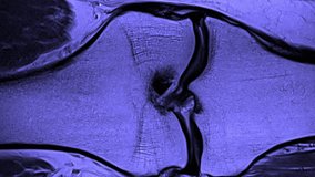 Time lapse of MRI human body scan, timelapse of monochrome magnetic resonance imaging of a human body parts. Stop motion layers view of CT scan with anatomical details. Seamless loop animation anatomy - Powered by Shutterstock - Get 15% off with code: PIKWIZARD15