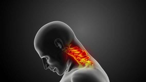 Cervical spine or neck injuries - Powered by Shutterstock - Get 15% off with code: PIKWIZARD15
