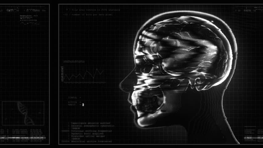 A medical style data screen showing a human head in a digital X-Ray style with various motion glitches and infographic elements.