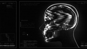 A medical style data screen showing a human head in a digital X-Ray style with various motion glitches and infographic elements. - Powered by Shutterstock - Get 15% off with code: PIKWIZARD15