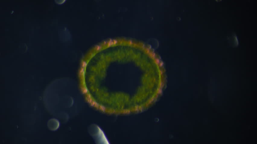Hydra. Cross section under microscope. Magnification 40x times. Study of unique asexual reproduction (amitosis). Concept of radically increasing human population Royalty-Free Stock Footage #3460700945