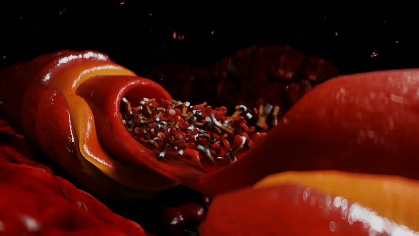 blood stream and cigarette butts. smoking health harm concept. Inside human body.