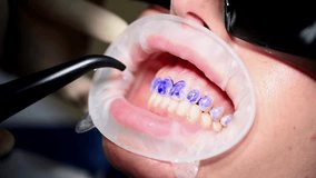 Professional dentist conducts a thorough check-up of woman teeth, inspecting for cavities, gum health, and overall oral hygiene. 4k cinematic raw slow motion video