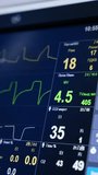 Cropped view of the monitor displaying the life signs. Close up. Lung ventilator machine screen controlling the patient's condition. Vertical video.