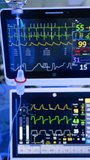 Monitors of lung ventilating machine with blurred curved lines of life parameters. Reservoir of drop counter hanging at foreground. Vertical video.