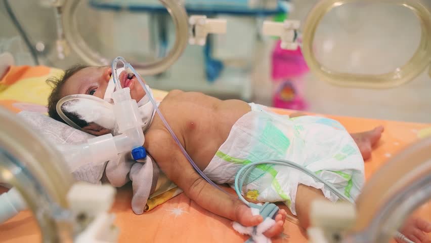 Closeup lovely little newborn baby infant lying in incubators for newborns, Newborn baby having the the breathing problem after birth, newborn in NICU, Neonatal intensive care unit. Royalty-Free Stock Footage #3473180479