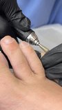 Hardware pedicure, foot treatment. Professional hardware pedicure using an electric device. Client on medical pedicure procedure. Podiatry clinic. Podology. High quality 4k footage