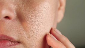 a close-up of the skin. Close-up of the skin. texture of oily skin with enlarged pores. The concept of problem skin care, modern Cosmetology Environmental influences - Powered by Shutterstock - Get 15% off with code: PIKWIZARD15