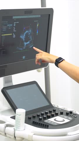 Female cardiologist doctor performing an echocardiogram on a patient in the hospital