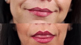 Close-up of woman's smile before and after zirconia veneers, dental ceramic crowns. Female patient smiling before and after cosmetic dental treatment by veneers. Smile makeover with ceramic veneers. - Powered by Shutterstock - Get 15% off with code: PIKWIZARD15