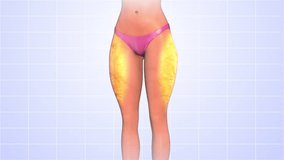Thigh fat reduction medical animation - Powered by Shutterstock - Get 15% off with code: PIKWIZARD15