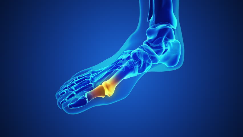 Painful gout inflammation on big toe joint