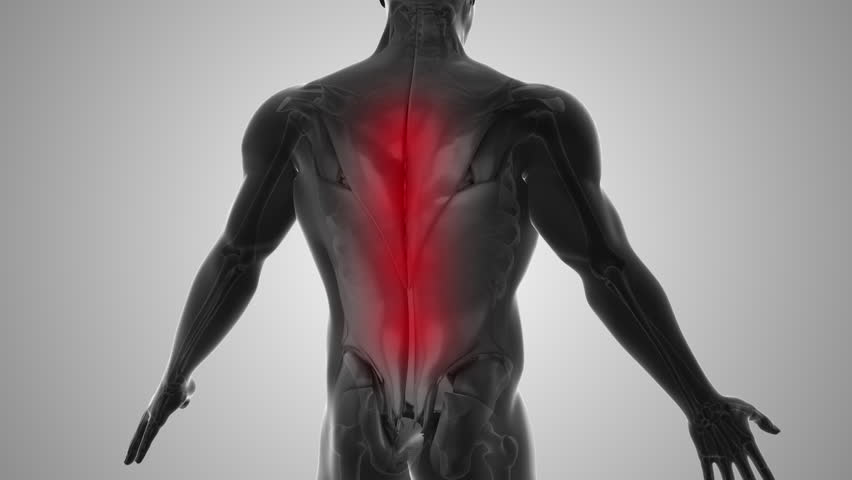 Back discomfort that triggers pain