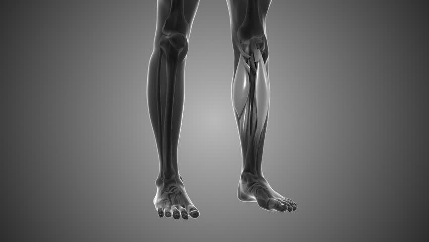 Shin discomfort that triggers pain