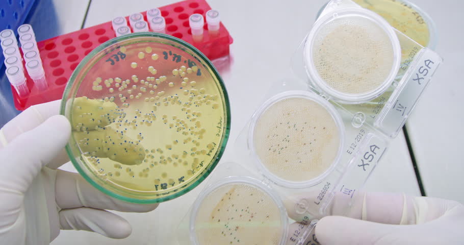 Technologist determines bacteria type comparing colony with samples in lab. Scientist researches microorganisms in artificial environment Royalty-Free Stock Footage #3492198791