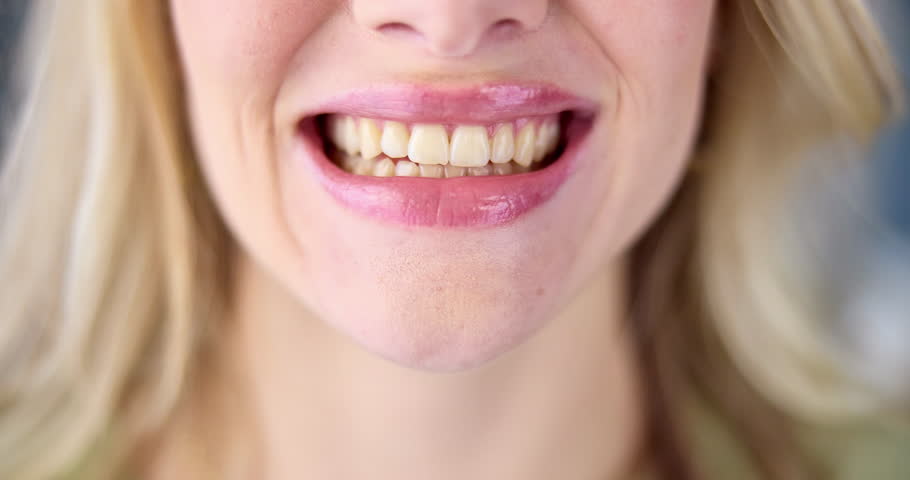 Dentistry, process and woman teeth for before and after with whitening for oral care cosmetics. Happy, smile and female person with mouth for dental hygiene treatment for stain removal versus results