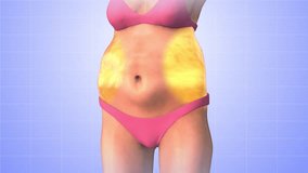 Stubborn fat reduction medical animation - Powered by Shutterstock - Get 15% off with code: PIKWIZARD15