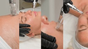 Close-up portrait of a beautiful aged woman during microneedling with dermapen from a beautician. Video collage.