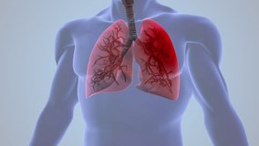Human Pleurisy Lung Inflammation Pain - Powered by Shutterstock - Get 15% off with code: PIKWIZARD15