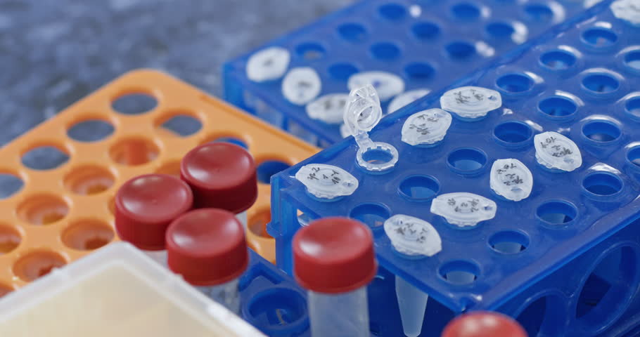 Assistant takes sample from test tube on rack in medical center closeup. Bio technologist researches human proteins in medical laboratory Royalty-Free Stock Footage #3494961157